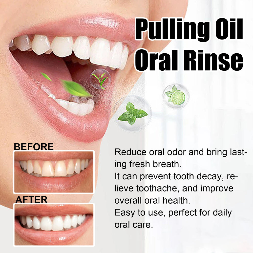 Gingival Repair Drops Coconut Mint Pulling Oil Mouthwash Relieves Toothache Remove Odor Fresh Breath Whiten Tool Mouth Care 30ml